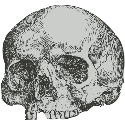 Medical Skull 3